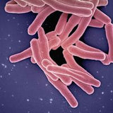 Bifidobacterium